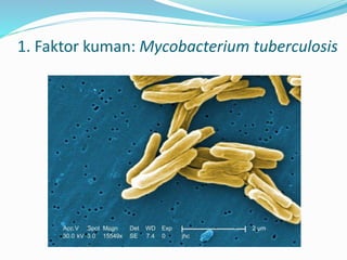 1. Faktor kuman: Mycobacterium tuberculosis
 