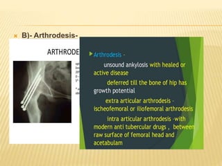  B)- Arthrodesis-
 