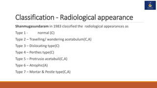 Radiological Classification R2 Tuberculosis of HIP Joint | PPTX