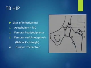 TB HIP
 Sites of infective foci
1. Acetabulum – MC
2. Femoral head/epiphyses
3. Femoral neck/metaphysis
(Babcock’s triangle)
4. Greater trochantrer
 