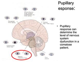 Pupillary response : Pupillary response can determine the level of nervous system dysfunction in a comatose patient. 