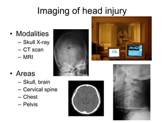 Imaging of head injury Modalities Skull X-ray CT scan MRI Areas Skull, brain Cervical spine Chest Pelvis 