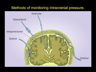 Methods of monitoring intracranial pressure . 