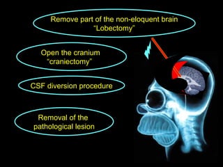 Removal of the  pathological lesion CSF diversion procedure Open the cranium  “ craniectomy”  Remove part of the non-eloquent brain “ Lobectomy” 