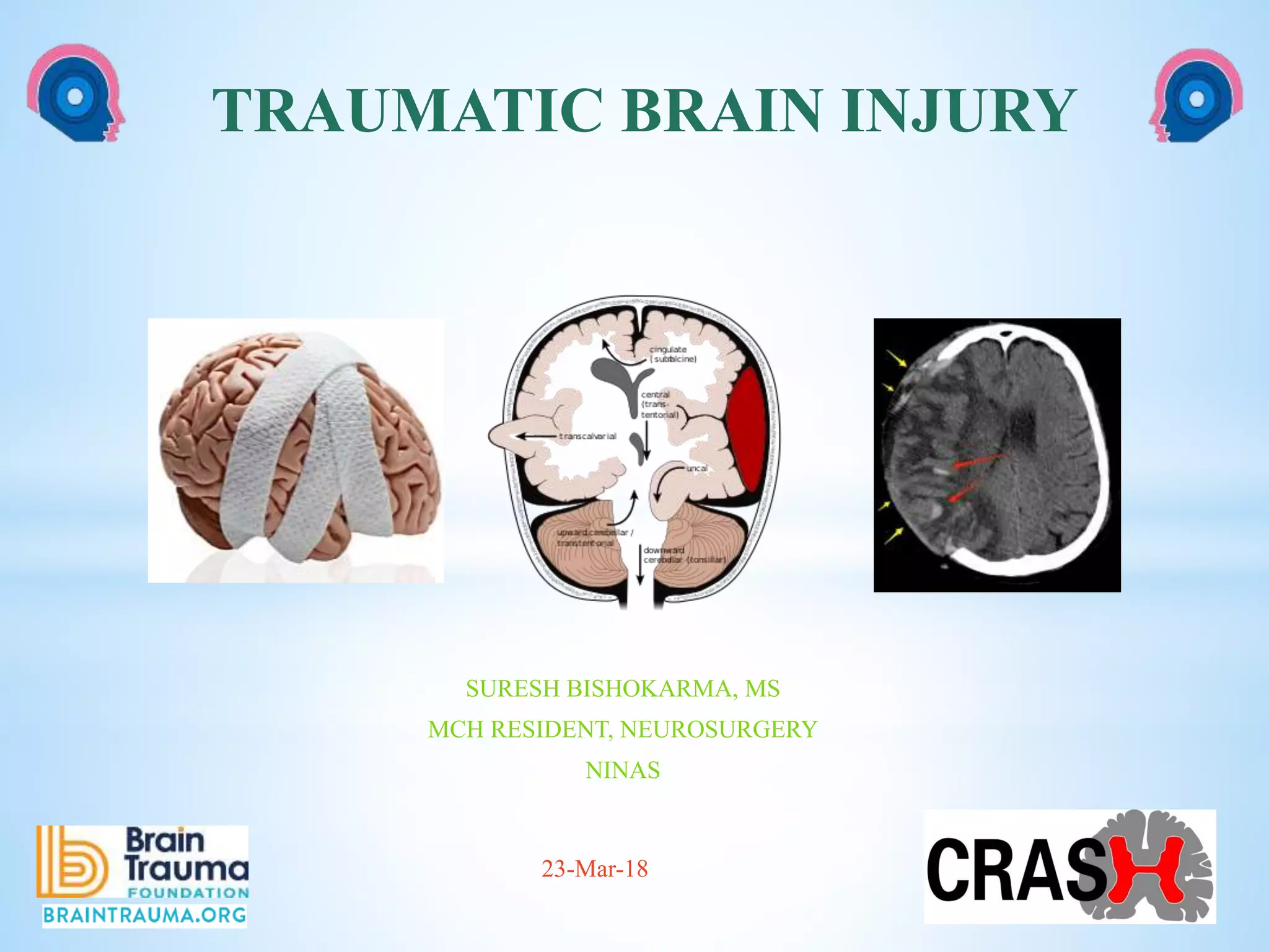 Traumatic Brain Inj Head Injury AKA Traumatic Brain Injury | PPTX