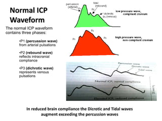 Normal ICP
Waveform
The normal ICP waveform
contains three phases:
•P1 (percussion wave)
from arterial pulsations
•P2 (rebound wave)
reflects intracranial
compliance
•P3 (dichrotic wave)
represents venous
pulsations
In reduced brain compliance the Dicrotic and Tidal waves
augment exceeding the percussion waves
 