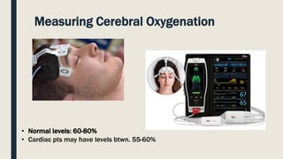 Measuring Cerebral Oxygenation
• Normal levels: 60-80%
• Cardiac pts may have levels btwn. 55-60%
 