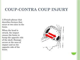 COUP-CONTRA COUP INJURY
A French phrase that
describes bruises that
occur at two sites in the
brain.
When the head is
struck, the impact
causes the brain to
bump the opposite side
of the skull. Damage
occurs at the area of
impact and on the
opposite side of the
brain.
 