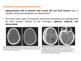 Traumatic Intracranial Hematoma
• Approximately half of patients with severe TBI and skull fracture have a
sizeable intracranial hematoma on initial head CT.
• The three major types of traumatic intracranial hematomas are distinguished
by their location relative to the meninges: epidural, subdural, and
intracerebral.
 