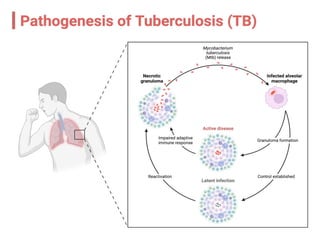 Pediatric Tuberculosis- Tuberculosis in Children | PPTX