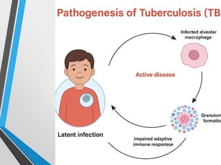 Pediatric Tuberculosis- Tuberculosis in Children | PPTX
