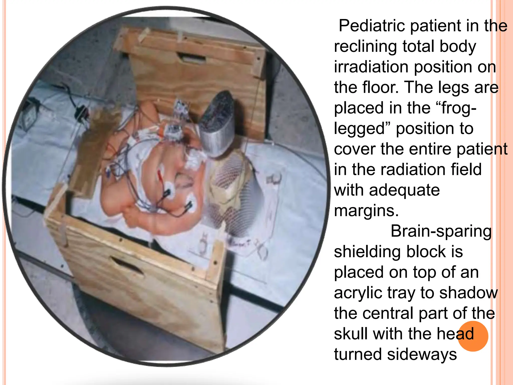 Tbi Radiotherapy Total body irradiation ppt for radiology.pptx