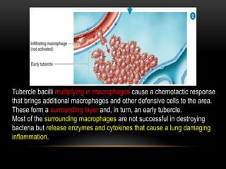 Tubercle bacilli multiplying in macrophages cause a chemotactic response
that brings additional macrophages and other defensive cells to the area.
These form a surrounding layer and, in turn, an early tubercle.
Most of the surrounding macrophages are not successful in destroying
bacteria but release enzymes and cytokines that cause a lung damaging
inflammation.
 