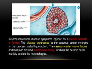 In some individuals, disease symptoms appear as a mature tubercle
is formed. The disease progresses as the caseous center enlarges
in the process called liquefaction. The caseous center now enlarges
and forms an air-filled tuberculous cavity in which the aerobic bacilli
multiply outside the macrophages.
 