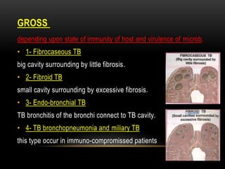 GROSS
depending upon state of immunity of host and virulence of microb.
• 1- Fibrocaseous TB
big cavity surrounding by little fibrosis.
• 2- Fibroid TB
small cavity surrounding by excessive fibrosis.
• 3- Endo-bronchial TB
TB bronchitis of the bronchi connect to TB cavity.
• 4- TB bronchopneumonia and miliary TB
this type occur in immuno-compromissed patients
 