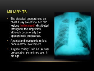 MILIARY TB
• The classical appearances on
chest X-ray are of fine 1–2 mm
lesions (‘millet seed’) distributed
throughout the lung fields,
although occasionally the
appearances are coarser.
• Anemia and leucopenia reflect
bone marrow involvement.
• ‘Cryptic’ miliary TB is an unusual
presentation sometimes seen in
old age
 