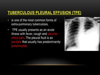 PLEURAL EFFUSION (TPE)
TUBERCULOUS
• is one of the most common forms of
extra-pulmonary tuberculosis.
• TPE usually presents as an acute
illness with fever, cough and pleuritic
chest pain. The pleural fluid is an
exudate that usually has predominantly
lymphocytes.
 