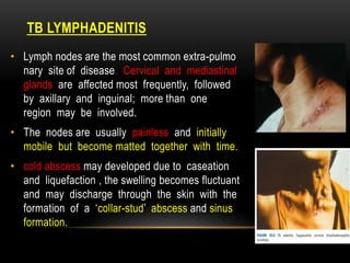 TB LYMPHADENITIS
• Lymph nodes are the most common extra-pulmo
nary site of disease. Cervical and mediastinal
glands are affected most frequently, followed
by axillary and inguinal; more than one
region may be involved.
• The nodes are usually painless and initially
mobile but become matted together with time.
• cold abscess may developed due to caseation
and liquefaction , the swelling becomes fluctuant
and may discharge through the skin with the
formation of a ‘collar-stud’ abscess and sinus
formation.
 