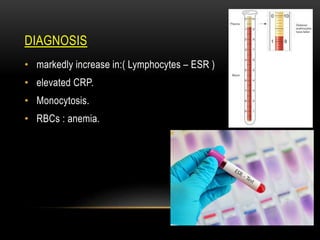 DIAGNOSIS
• markedly increase in:( Lymphocytes – ESR )
• elevated CRP.
• Monocytosis.
• RBCs : anemia.
 