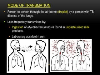 TRANSMATION
MODE OF
• Person-to-person through the air-borne (droplet) by a person with TB
disease of the lungs.
 Less frequently transmitted by:
• Ingestion of Mycobacterium bovis found in unpasteurized milk
products.
• Laboratory accident (rare).
 