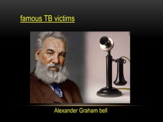 famous TB victims
Alexander Graham bell
 