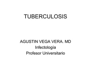 TUBERCULOSIS
AGUSTIN VEGA VERA. MD
Infectología
Profesor Universitario
 