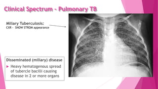 Clinical Spectrum – Pulmonary TB
Disseminated (miliary) disease
 Heavy hematogenous spread
of tubercle bacilli causing
disease in 2 or more organs
Miliary Tuberculosis:
CXR - SNOW STROM appearance
 