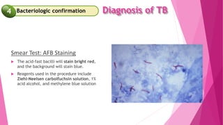 Diagnosis of TB
Smear Test: AFB Staining
 The acid-fast bacilli will stain bright red,
and the background will stain blue.
 Reagents used in the procedure include
Ziehl–Neelsen carbolfuchsin solution, 1%
acid alcohol, and methylene blue solution
Bacteriologic confirmation
4
 