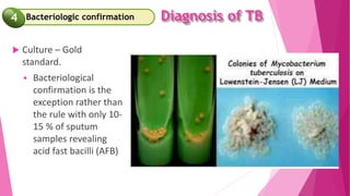 Diagnosis of TB
 Culture – Gold
standard.
 Bacteriological
confirmation is the
exception rather than
the rule with only 10-
15 % of sputum
samples revealing
acid fast bacilli (AFB)
Bacteriologic confirmation
4
 