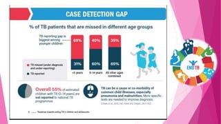 Tuberculosis - Burden
 