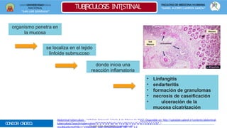 UNIVERSIDAD
NACIONAL
“SAN LUIS GONZAGA”
FACULTAD DE MEDICINA HUMANA
“DANIEL ALCIDES CARRÌON GARCÌA”
TUB[RCULOSIS INT[STINAL
CONDORI OROSCO
,
organismo penetra en
la mucosa
se localiza en el tejido
linfoide submucoso
donde inicia una
reacción inflamatoria
• Linfangitis
• endarteritis
• formación de granulomas
• necrosis de caseificación
• ulceración de la
mucosa cicatrización
Abdominal tuberculosis - UpToDate [Internet]. [citado 6 de febrero de 2022]. Disponible en: http://uptodate.yabesh.ir/contents/abdominal-
tuberculosis?search=tuberculosisD
%es
2ca
0rg
aa
bdo
dopo
mr K
ie
nv
ain
l&(k
sav
os
u64
rc@
eh
=ot
sm
ea
ail.
rc
co
hm
_)
result&selectedTitle=1"150&usage_type=default&display_ran =1 1 2
Encuentra más documentos en www.udocz.com
 