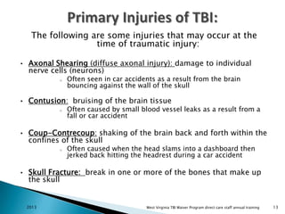 Tbi overview | PPT