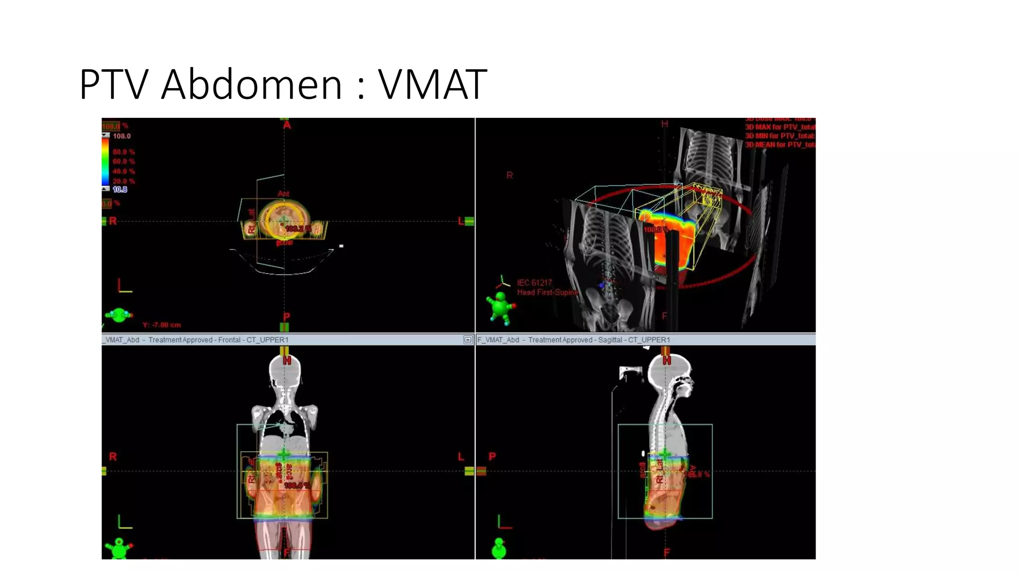 Total body irradiation tbi planning pptx