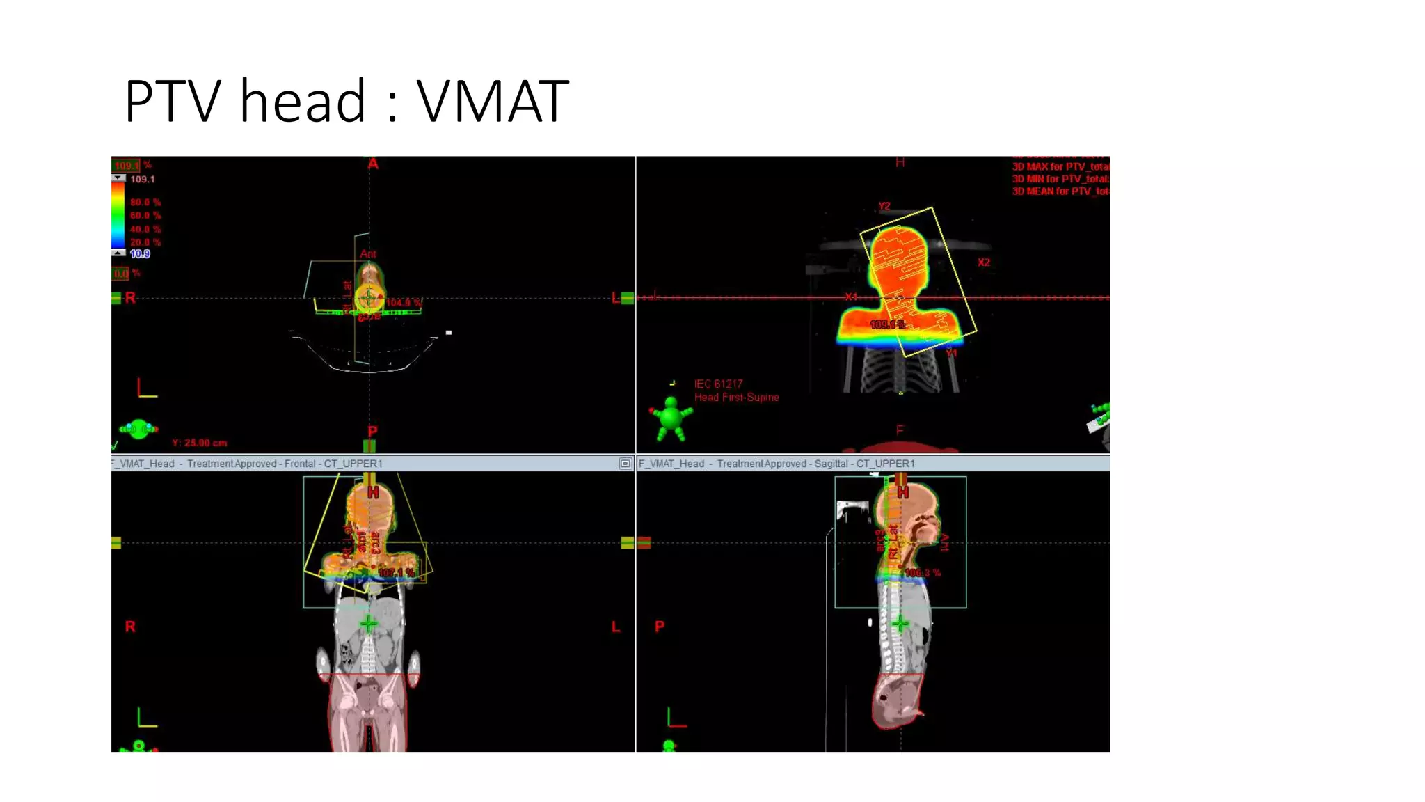 Total body irradiation tbi planning pptx