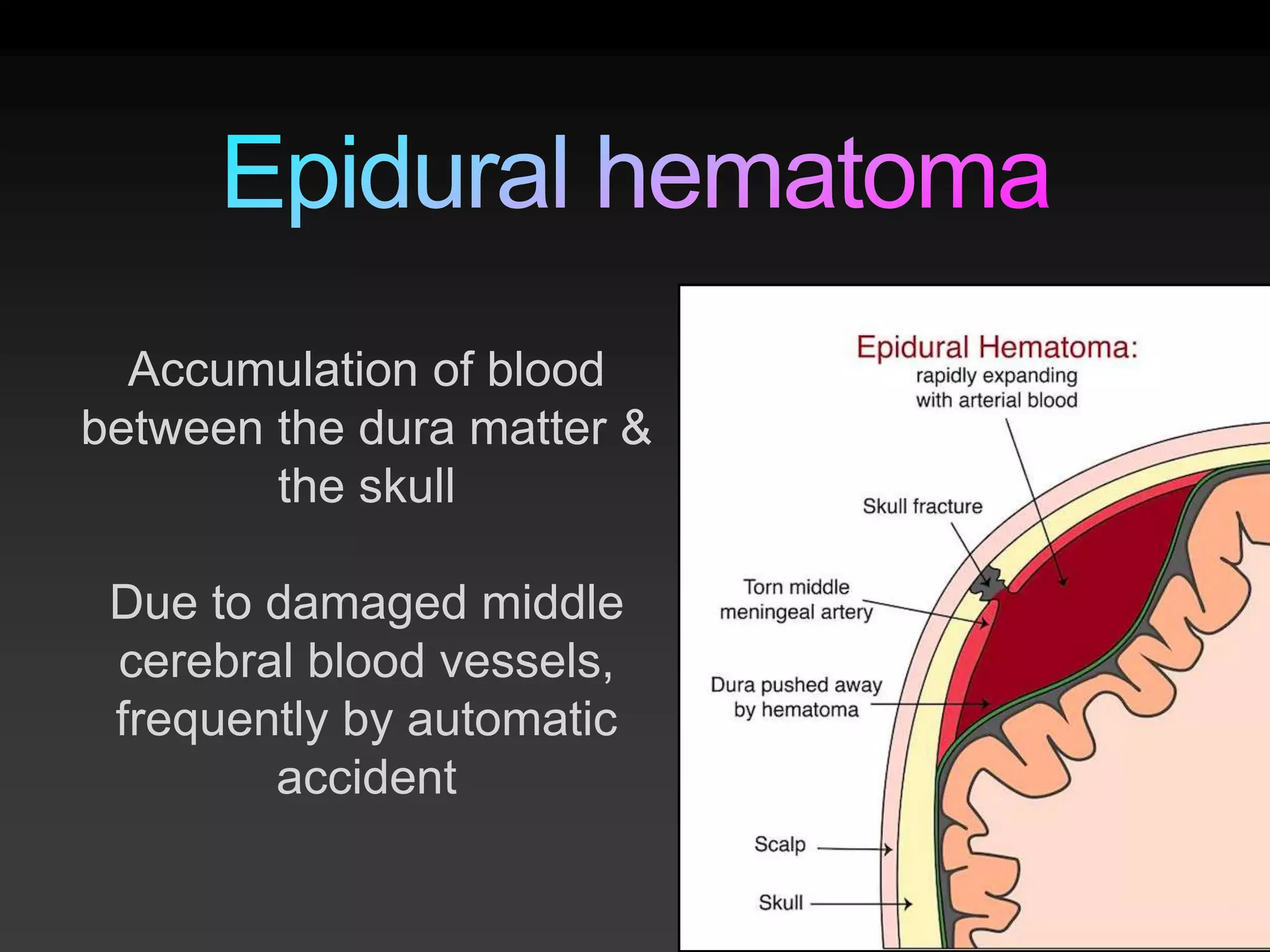 Traumatic Brain Injury (TBI) | PPT