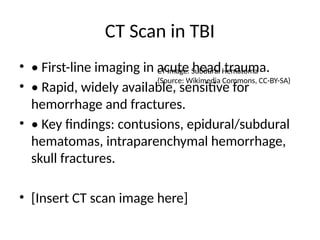 Traumatic Brain Injury [TBI] Radiology_Imaging | PPTX