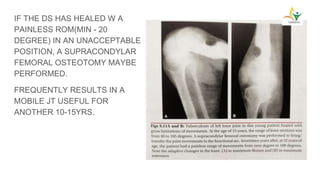 IF THE DS HAS HEALED W A
PAINLESS ROM(MIN - 20
DEGREE) IN AN UNACCEPTABLE
POSITION, A SUPRACONDYLAR
FEMORAL OSTEOTOMY MAYBE
PERFORMED.
FREQUENTLY RESULTS IN A
MOBILE JT USEFUL FOR
ANOTHER 10-15YRS.
 