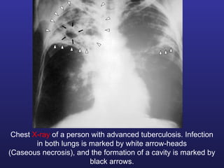Tb lab | PPT