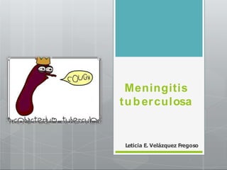 Meningitis
tuberculosa
Leticia E. Velázquez Fregoso
 