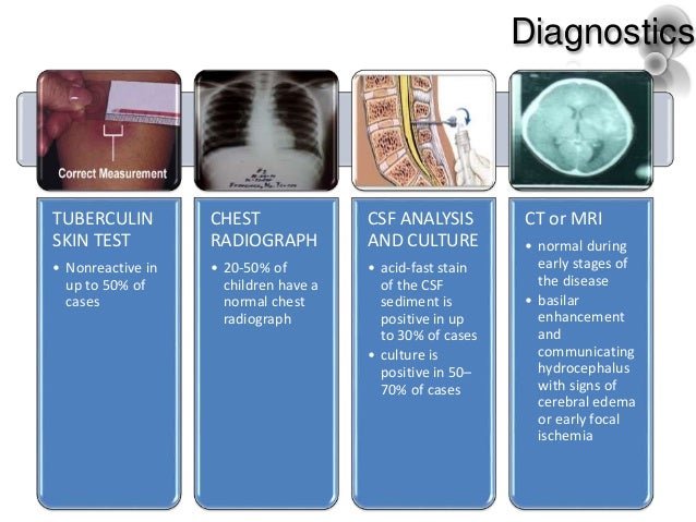 Icd 10 Cm Code For Tb Skin Test