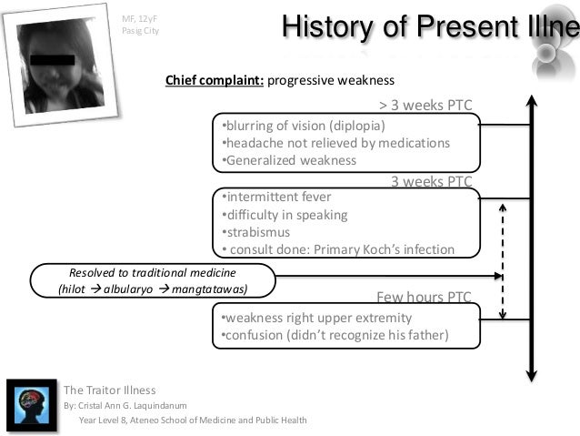 for weakness paracetamol Meningitis TB