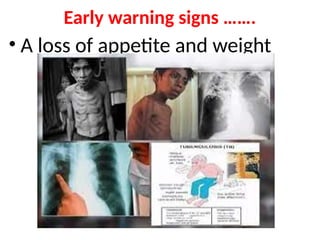 • A loss of appetite and weight
Early warning signs …….
 