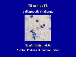 TB or not TB
a diagnostic challenge
Samir Haffar M.D.
Assistant Professor of Gastroenterology
 