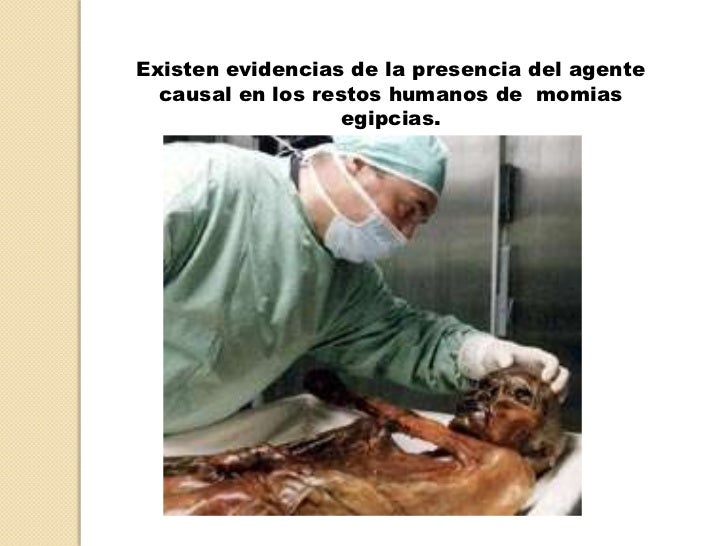 Resultado de imagen para la tuberculosis EN MOMIAS EGIPCIAS