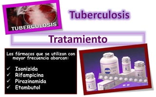 Tratamiento
Los fármacos que se utilizan con
mayor frecuencia abarcan:
 Isonizida
 Rifampicina
 Pirazinamida
 Etambutol
 