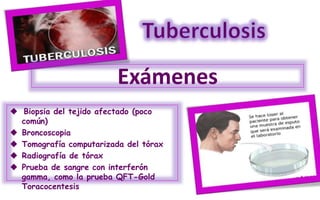 Exámenes
 Biopsia del tejido afectado (poco
común)
 Broncoscopia
 Tomografía computarizada del tórax
 Radiografía de tórax
 Prueba de sangre con interferón
gamma, como la prueba QFT-Gold
Toracocentesis
 