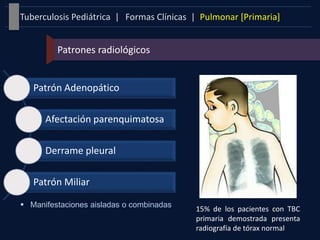 Formas Clínicas | Pulmonar [Primaria]Tuberculosis Pediátrica |
Patrones radiológicos
 Manifestaciones aisladas o combinadas
Patrón Adenopático
Afectación parenquimatosa
Derrame pleural
Patrón Miliar
15% de los pacientes con TBC
primaria demostrada presenta
radiografía de tórax normal
 
