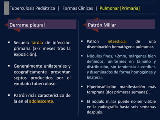 Formas Clínicas | Pulmonar [Primaria]Tuberculosis Pediátrica |
Derrame pleural
 Secuela tardía de infección
primaria (3-7 meses tras la
exposición).
 Generalmente unilaterales y
ecograficamente presentan
septos producidos por el
exudado tuberculoso.
 Patrón más característico de
la en el adolescente.
Patrón Miliar
 Patrón intersticial de una
diseminación hematógena pulmonar.
 Nódulos finos, >2mm, márgenes bien
definidos, uniformes en tamaño y
distribución, sin tendencia a confluir,
y diseminados de forma homogénea y
bilateral.
 Hiperinsuflación manifestación más
temprana (dos primeras semanas).
 El nódulo miliar puede no ser visible
en la radiografía hasta seis semanas
después.
 