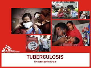 TUBERCULOSIS
Dr.Samsuddin Khan
 