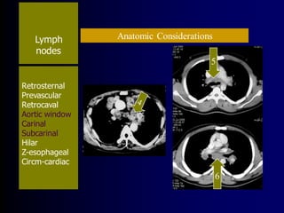 Lymph
nodes
Anatomic Considerations
Retrosternal
Prevascular
Retrocaval
Aortic window
Carinal
Subcarinal
Hilar
Z-esophageal
Circm-cardiac
6
5
 